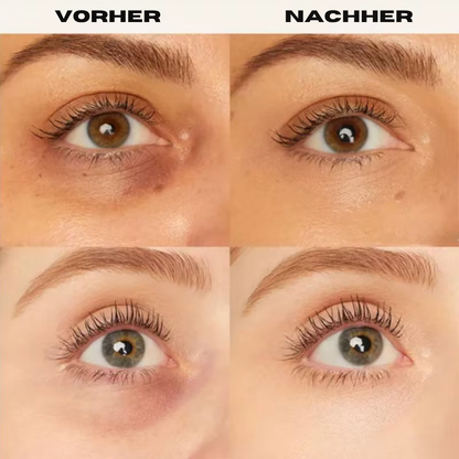 All-in-One Concealer